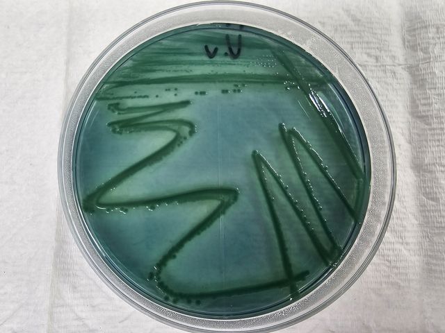 비브리오패혈증균