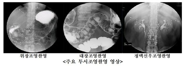주요 투시조영촬영 영상