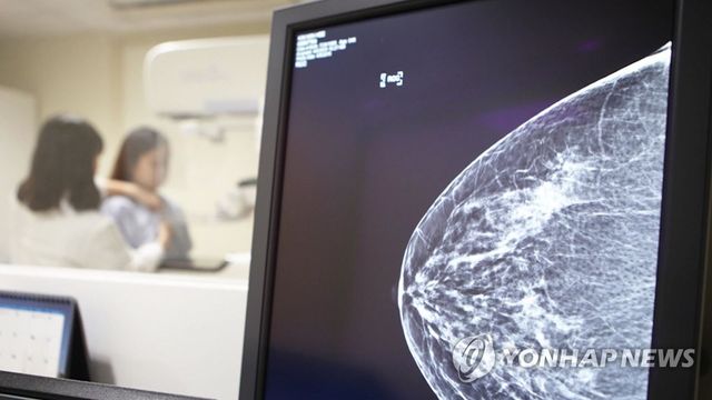유방암 검사