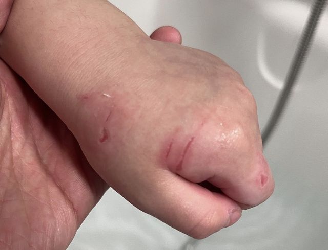 게시글 속 사진 