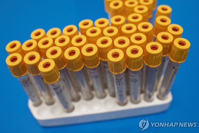 혈액 샘플 채취용 시험관