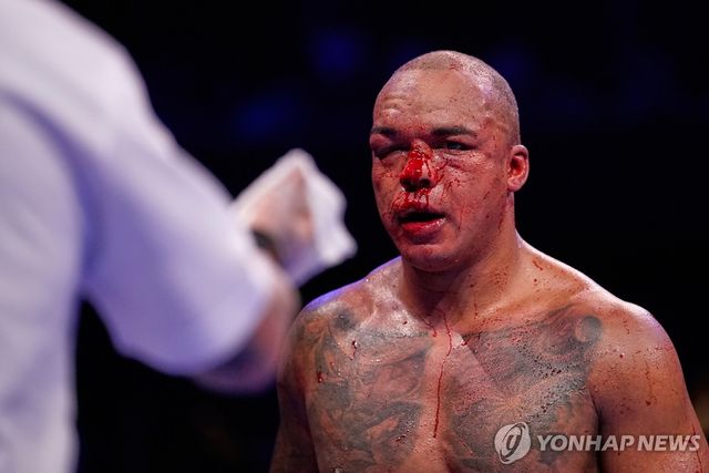 얼굴이 피로 물든 파비오 워들리