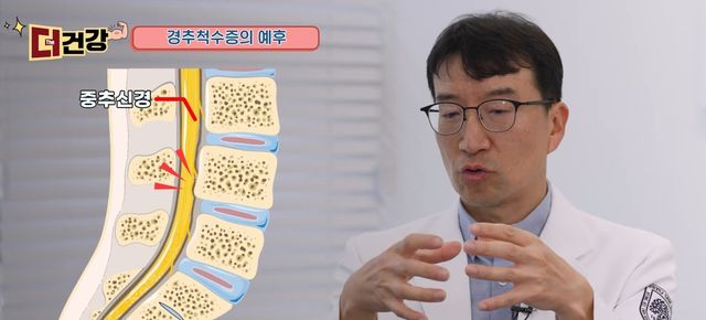 경희대병원 정형외과 강경중 교수