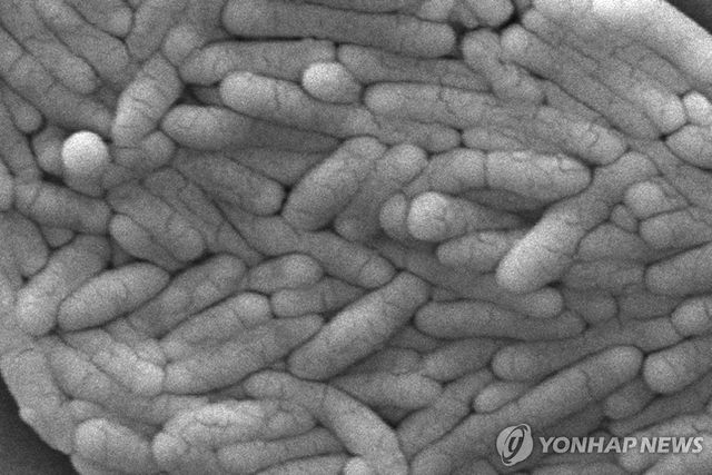설사 등을 일으키는 살모넬라균