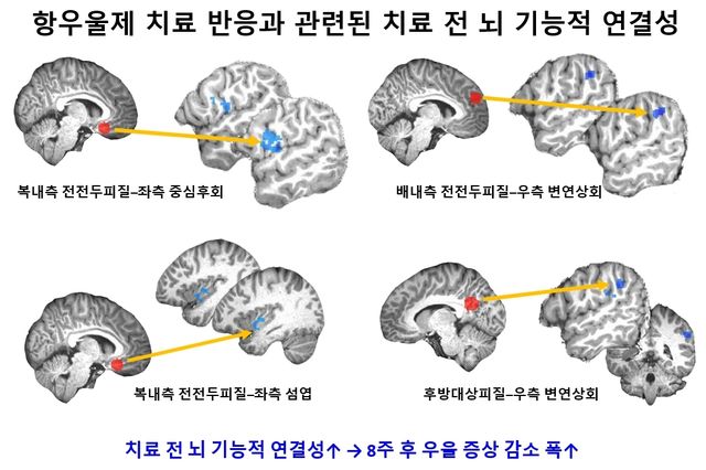 [서울대병원 제공]