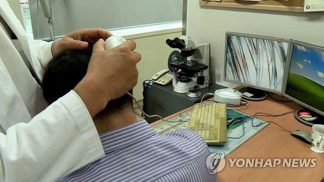 남성 탈모 치료