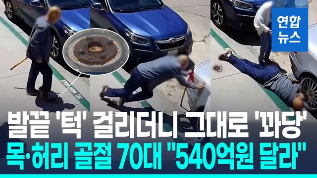 [영상] 5㎝ 볼트에 걸려 골절된 美남성…3천500만달러 거액 소송 - 2