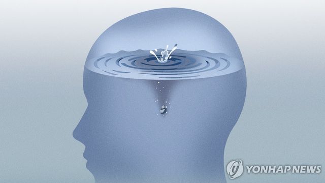 집중력 저하(PG)