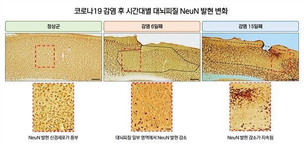 코로나19 감염 후 시간대별 대뇌피질 NeuN 발현 변화 추이