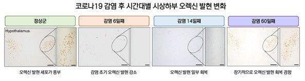 코로나19 감염 후 시간대별 시상하부 오렉신 발현 변화 추이