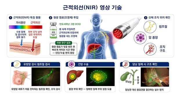 근적외선 영상 기술