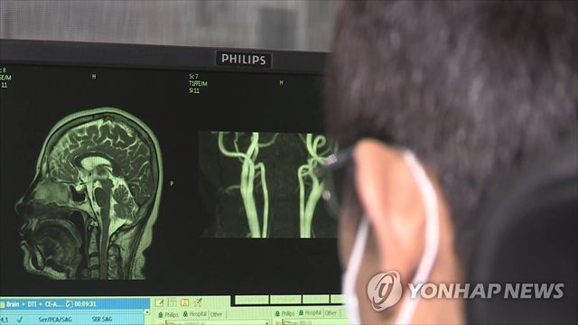 뇌질환