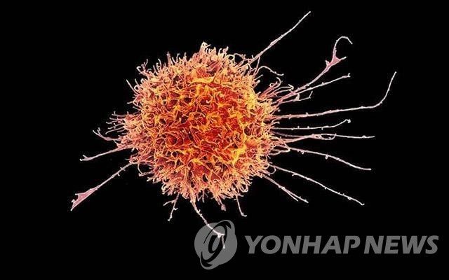 NK세포의 전자 현미경 이미지