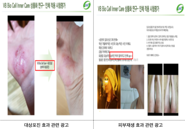 무허가 제품 제조·판매업체 적발 해당 제품 광고자료 /식품의약품안전처