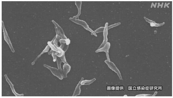 영상제공 국립감염병연구소/NHK 10월 27일 보도분 갈무리(포인트경제)