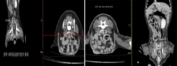 반려견 대상 폴리탁셀 4.5mg/kg 항암효능시험 결과, 림프절 전이암 크기. (좌)투약 전 림프절 전이암 크기(가로 10.06mm-세로 6.63mm-높이 19.35mm), (우)투약 후 림프절 전이암 크기(가로 5.91mm-세로 3.98mm-높이 14.26mm)./현대바이오 제공