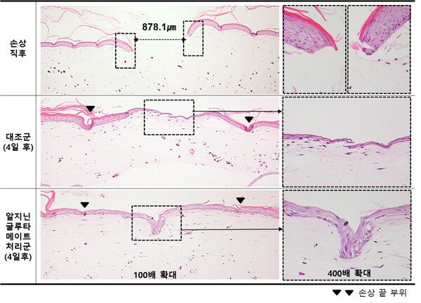 LG생활건강, 인공 피부 손상 후 피부 재생 효능 평가 결과