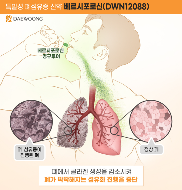대웅제약 베르시포로신(DWN12088) 작용 기전
