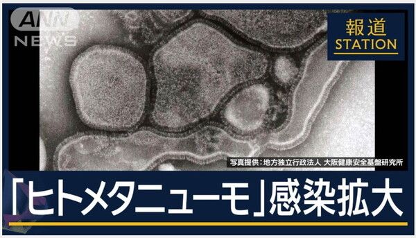 사람 메타뉴모바이러스 감염확대/테레아사 지난 달 10일 보도분 갈무리(포인트경제)