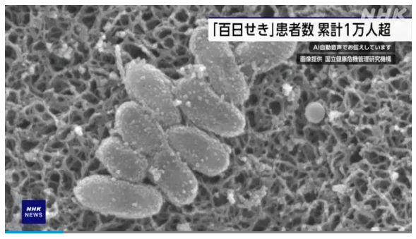 전자현미경으로 촬영한 백일해균/NHK 보도분 캡쳐(포인트경제)