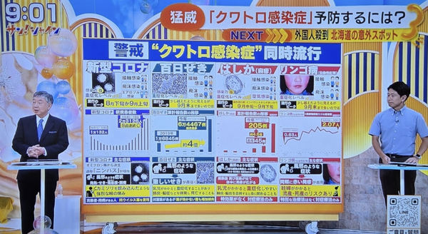 일본 아침 프로그램에서 쿠와토로 감염증 동시 유행을 다룬 방송 장면/후지TV 방영분 갈무리(포인트경제)