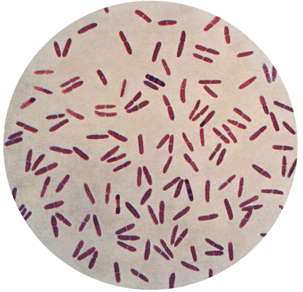아급성 결막염 환자의 배양 검체에서 다수의 모락셀라 라쿠나타(Moraxella lacunata) 박테리아가 관찰된 현미경 사진 /퍼블릭 도메인