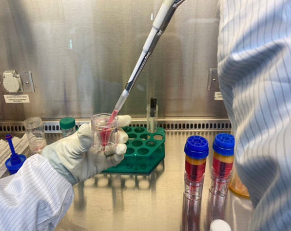 상층액을 따라내고 SVF를 분리하는 과정 /연세사랑병원 제공