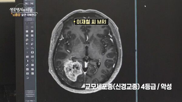 사진=생로병사의 비밀
