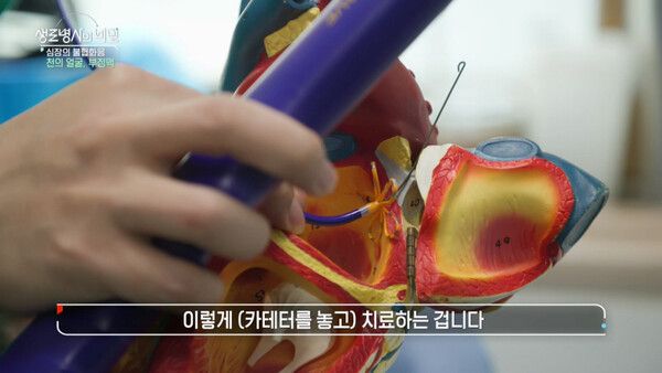 사진=생로병사의 비밀