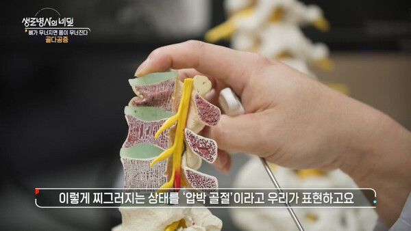 사진=생로병사의 비밀