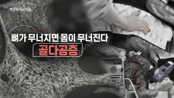 사진=생로병사의 비밀