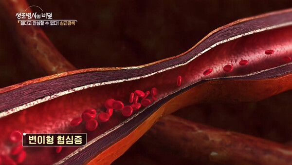 사진=생로병사의 비밀