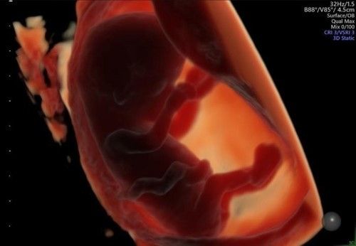 3D 질식 초음파 촬영 임신 태아 모습. 사진=연합뉴스