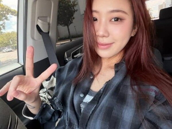 성형 고백 후 셀카를 공개한 이영지. 사진=공식 SNS
