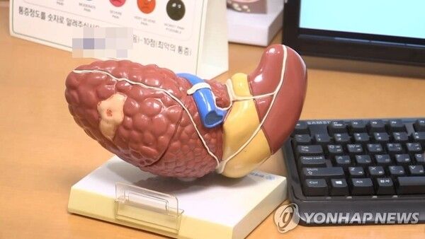 지방간. 사진=연합뉴스