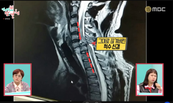 박위 전신마비 이유, 송지은 프로필·직업·나이 (사진출처=MBC전지적참견시점)