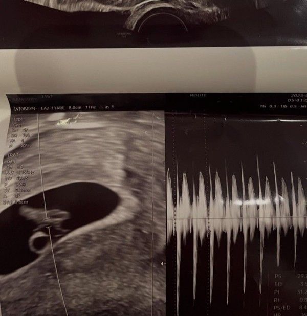 사진=서민재&nbsp;SNS