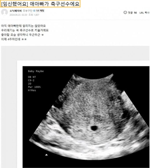 손흥민 협박녀 여자 초음파 추정 사진 / 디시인사이드 사이트 캡쳐&nbsp;