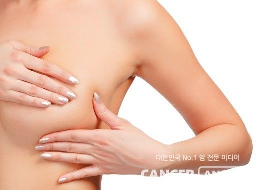 BRCA1·2 유전자 돌연변이가 없어도 한쪽에 유방암이 생기면 다른 쪽에도 유방암이 생길 위험이 높다는 연구 결과가 나왔다.&nbsp;서울대병원 유방내분비외과 문형곤·강은혜 교수가 2005년부터 2018년까지 서울대병원에서 치료받은 유방암 환자 1만3107명의 데이터를 활용해 전체 생존율과 반대편 유방암 발생 위험을 분석한 결과다. ./캔서앤서DB