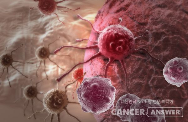 달세포분열을 더 이상 하지 않는 노화 암세포가 암세포의 생존과 전이를 촉진한다는 연구결과가 나왔다.&nbsp;/ 게티이미지뱅크