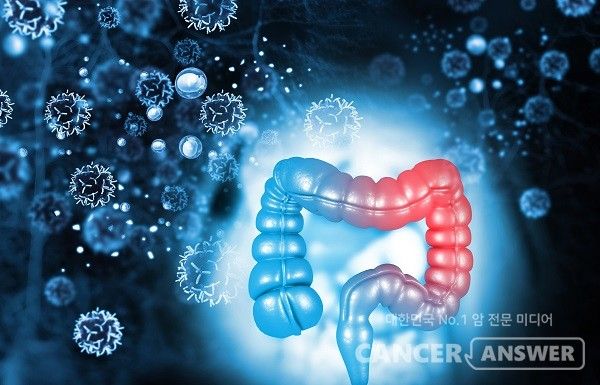 대장암 가족력이 없고 첫 대장 내시경 검사에서 문제가 없다면 다음 대장 내시경은 15년 뒤에 받아도 괜찮다는 해외 연구 결과가 나왔다. / 게티이미지뱅크