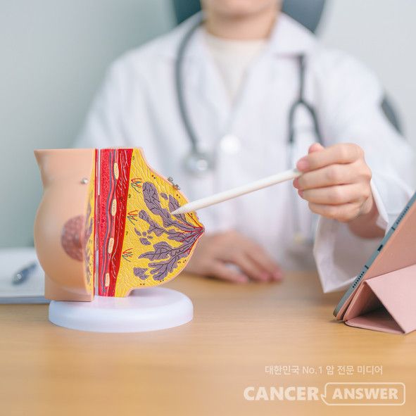 유방암을 로봇·내시경 수술로 하면 기존 절개술보다 유두·유륜 괴사 위험을 3분의 1로 줄일 수 있다는 연구 결과가 나왔다. 유두·유륜 괴사는 유방암 수술 후 유두 조직 세포가 썩는 합병증으로, 환자 자존감에 영향을 준다./게티이미지뱅크