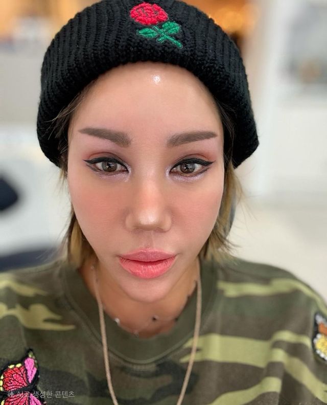 댄스 듀오 '클론' 출신 강원래의 아내 김송이 건강 이상을 호소했다.&nbsp;김송은 지난 17일 자신의 소셜미디어에 "이게 웬일이래요. 주말 동안 통증은 진통제로 잡았는데 입안 윗 천장 고름이 차서 침 삼키기가 불편할 정도였다"고 썼다. 그는 대학병원에서 진료를 받을 예정인 것으로 알려졌다./김송 인스타그램 캡처