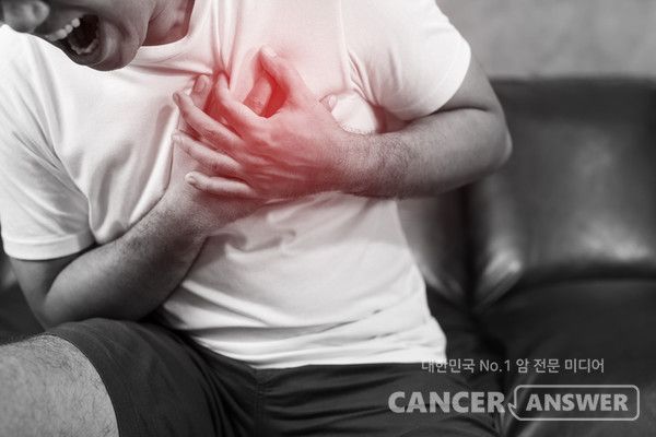 암경험자가&nbsp;급성 심장마비가 생길 위험이&nbsp;암 경험이 없는 사람의 3배 이상이라는 연구 결과가 국제학술지 ‘BMC 캔서(BMC cancer)’에 최근 게재됐다./게티이미지뱅크