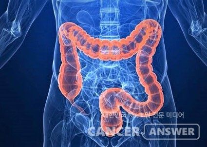 가천대 길병원은 최승준 영상의학과 교수팀이 인공지능(AI) 기반 기계학습 기법인 ‘라디오믹스 모델’을 개발, 대장암에서 간으로 전이된 환자들의 치료 반응과 생존율 예측 정확성을 크게 높였다고 1일 밝혔다./ 게티이미지뱅크