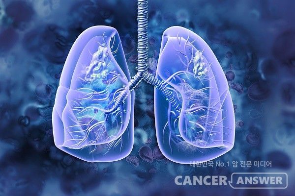 KRAS G12C 유전자 변이를 표적으로 삼는 차세대 항암제가 1상 임상시험에서 고형암 환자에게 73.5%에 달하는 객관적 반응률(ORR)을 보인 것으로 나타났다.&nbsp;연세암병원 폐암센터 조병철·임선민 교수 연구팀은 비소세포폐암, 대장암, 췌장암 환자를 대상으로 한 KRAS G12C 표적 치료제의 1상 임상 결과를 12일 공개했다. 이 연구는 세계적인 의학 학술지 ‘네이처 메디슨(Nature Medicine, IF 58.7)’에 게재됐다./ 게티이미지뱅크