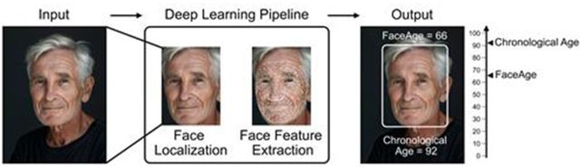 얼굴 사진으로 생물학적 나이를 추정하고 암 치료 예후를 예측하는 인공지능 '페이스에이지'(FaceAge)의 작동 원리. 촬영 사진을&nbsp; AI로 분석해 생물학적 나이를 예측하고 암환자의 생존율까지 계산해준다. 매사추세츠종합병원 홈피