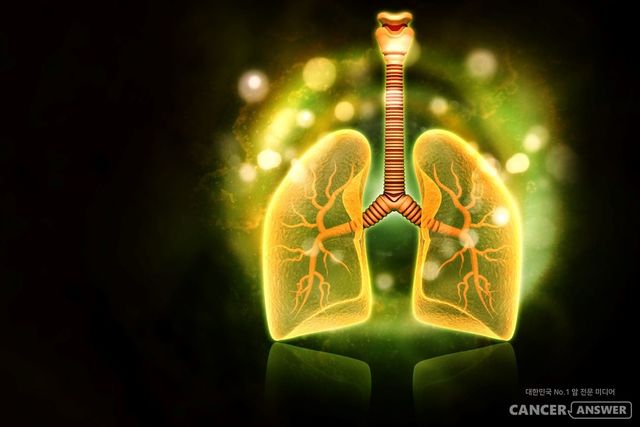 비정형 EGFR 유전자 변이 비소세포폐암에 3세대 EGFR 표적치료제인 레이지티닙이 효과가 있다는 사실을 국내 의료진이 확인했다.&nbsp;연세암병원 폐암센터 홍민희 교수와 삼성서울병원 혈액종양내과 박세훈 교수는 비정형 EGFR 변이에 대한 3세대 EGFR 표적치료제 레이저티닙의 객관적 반응률이 50%에 달했다고 16일 밝혔다. 이 연구결과는 세계폐암연구협회 학회지(Journal of Thoracic Oncology)에 게재됐다.&nbsp;/ 게티이미지뱅크