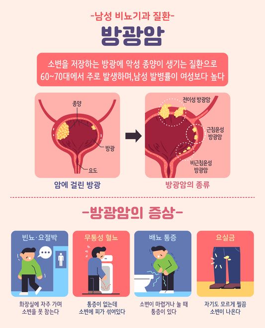 방광암은 초기라도 재발할 가능성이 높은 암이다. 전체 암 중에서 재발률이 매우 높은 편에 속한다.특히 점막과 점막하층에 국한된 초기 단계의 방광암은 1년 내 재발률이 15~61%, 5년 내에는 최대 78%에 이를 수 있다는 연구가 있다. 초기 방광암 수술 후 재발이 예외적인 사례가 아니라는 의미다./게티이미지뱅크