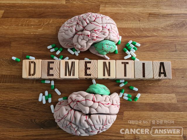 2025년 9월 국제학술지 ‘이바이오메디신(eBioMedicine)’에 발표된 연구에 따르면, 전 세계 치매의 최대 65%는 수정 가능한 위험 요인을 관리함으로써 예방 가능하다는 분석이 제시됐다./게티이미지뱅크